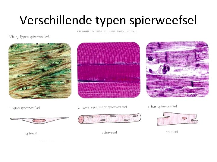Verschillende typen spierweefsel 