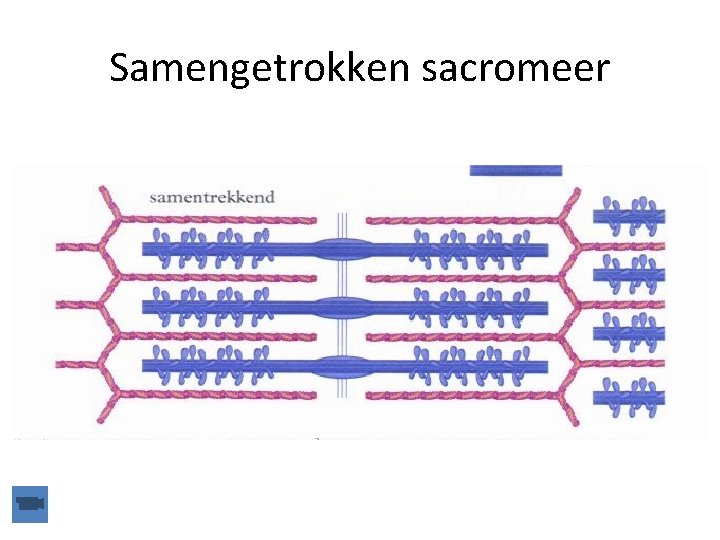 Samengetrokken sacromeer 