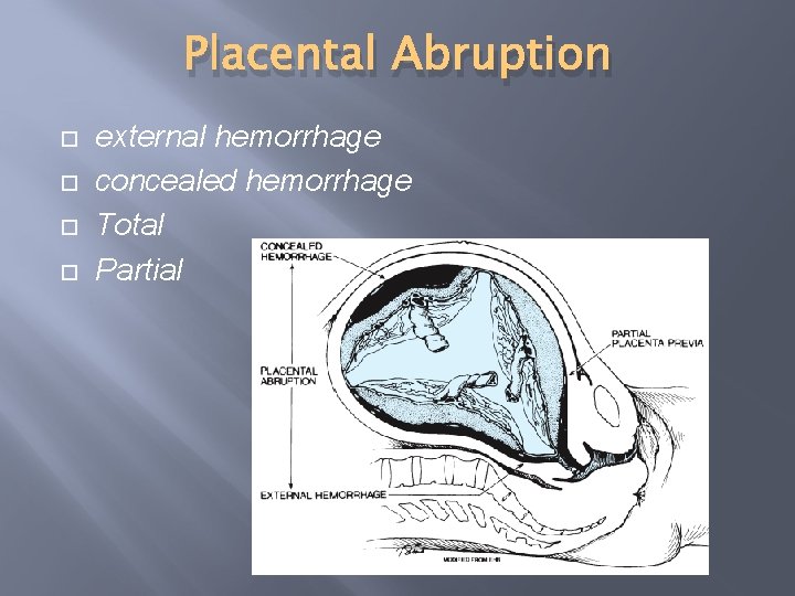 Placental Abruption external hemorrhage concealed hemorrhage Total Partial 