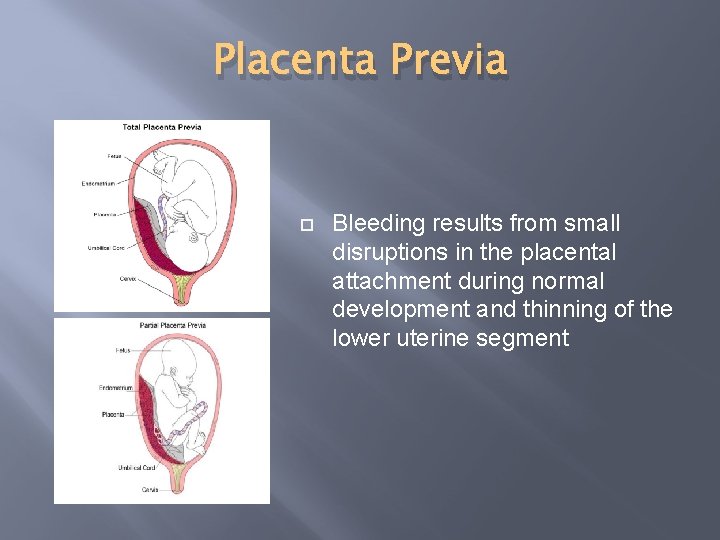 Placenta Previa Bleeding results from small disruptions in the placental attachment during normal development