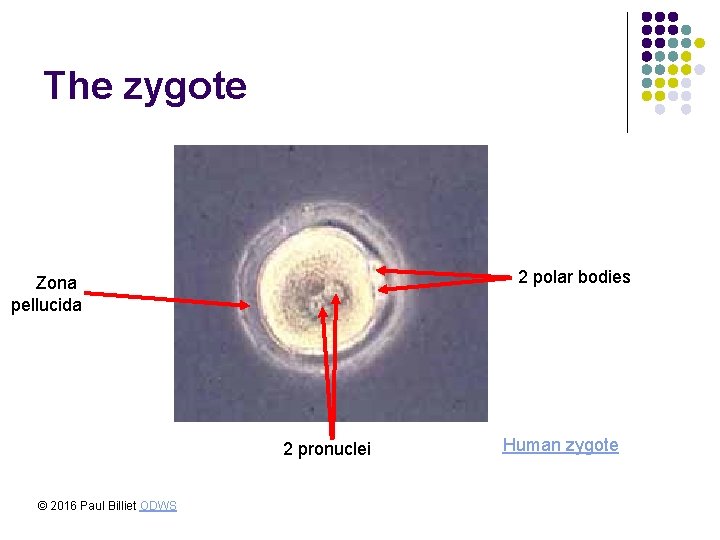 The zygote 2 polar bodies Zona pellucida 2 pronuclei © 2016 Paul Billiet ODWS