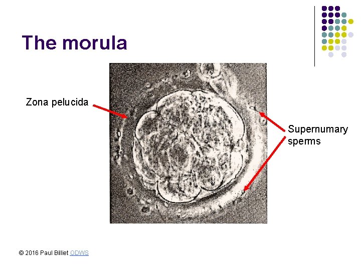 The morula Zona pelucida Supernumary sperms © 2016 Paul Billiet ODWS 