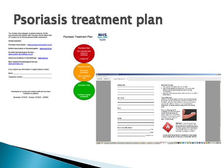 Psoriasis treatment plan 