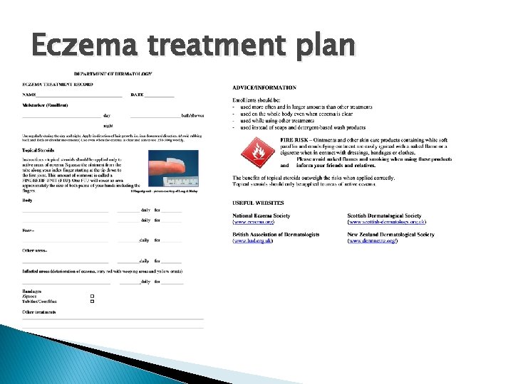 Eczema treatment plan 