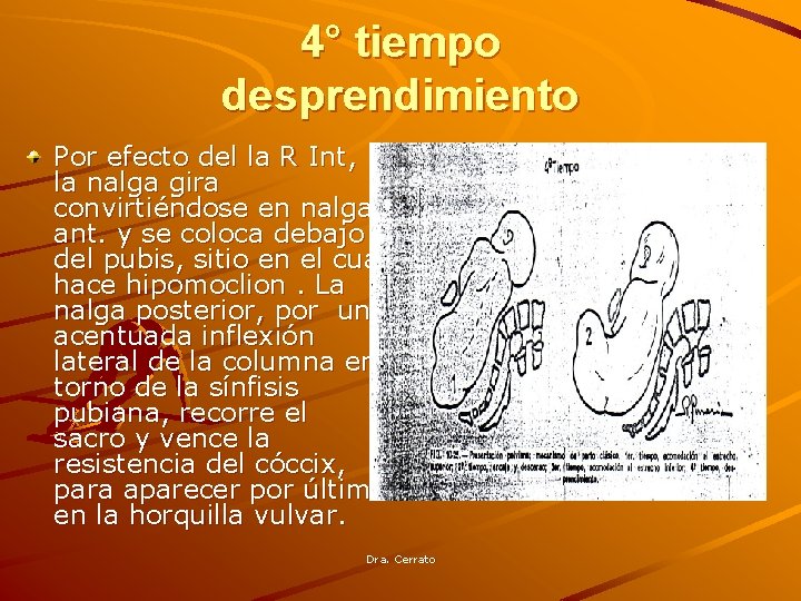 4° tiempo desprendimiento Por efecto del la R Int, la nalga gira convirtiéndose en