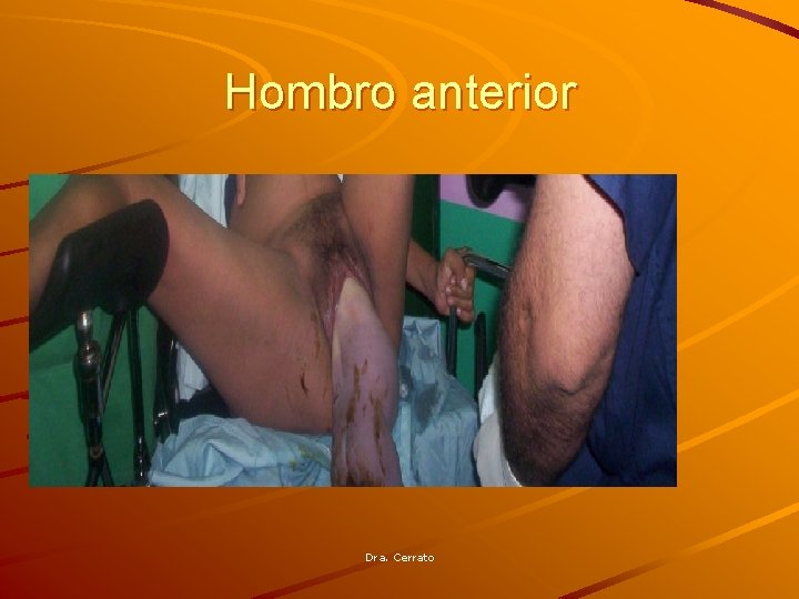 Hombro anterior Dra. Cerrato 