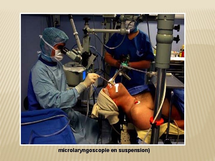 microlaryngoscopie en suspension) 