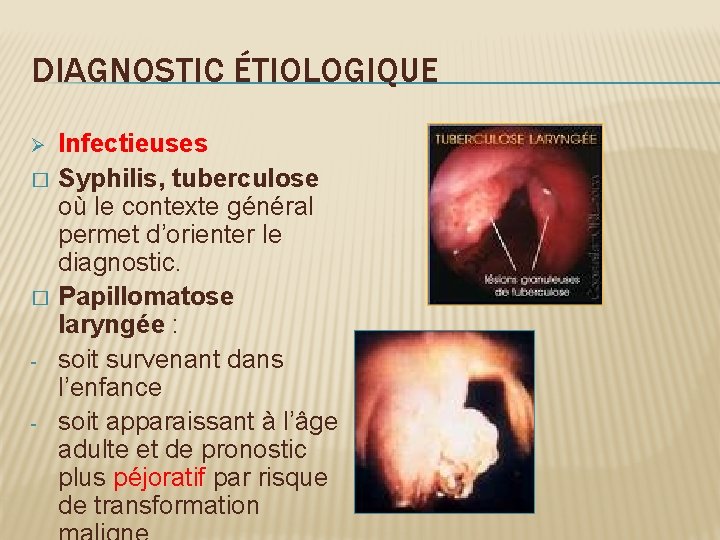 DIAGNOSTIC ÉTIOLOGIQUE Ø � � - Infectieuses Syphilis, tuberculose où le contexte général permet