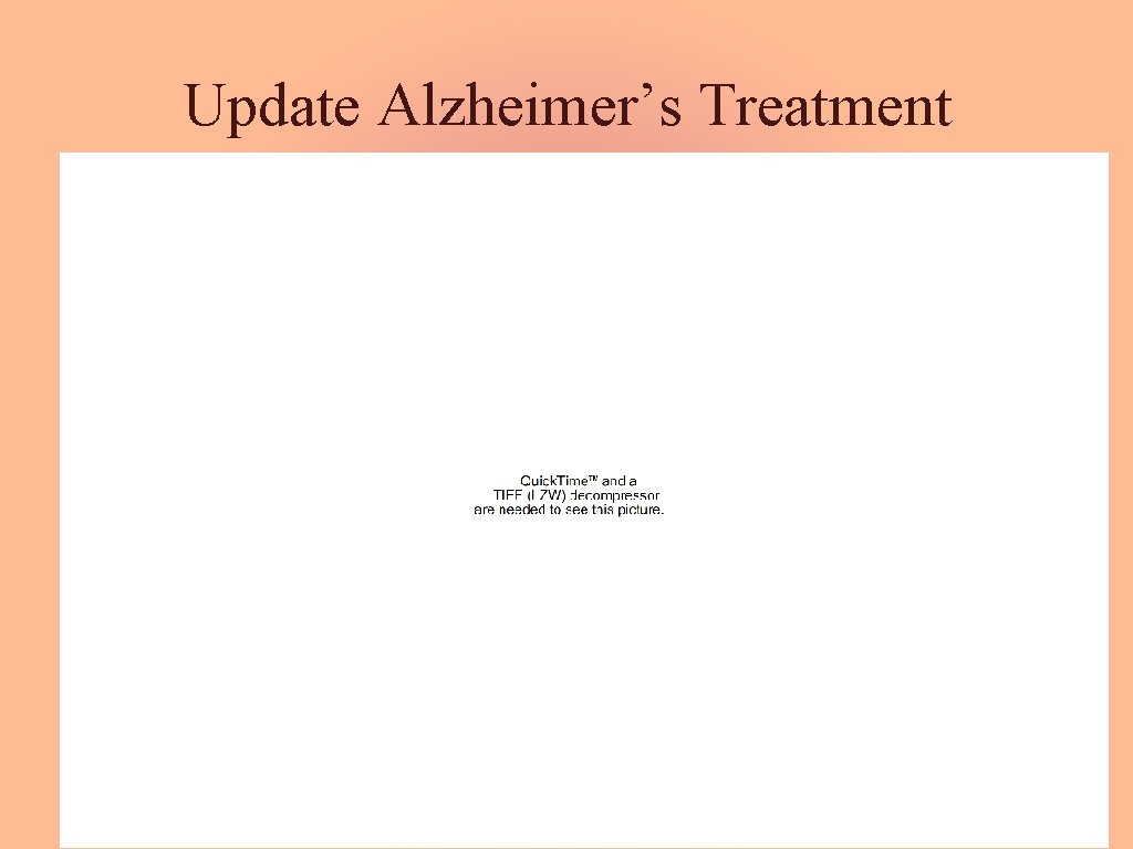 Update Alzheimer’s Treatment 