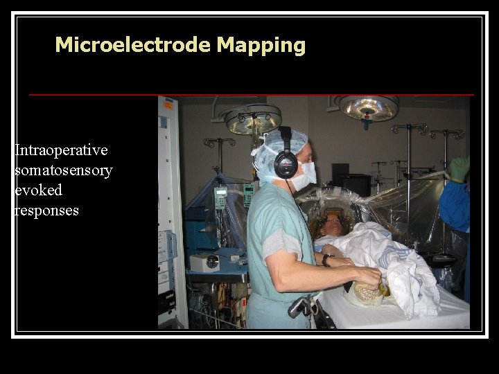 Microelectrode Mapping Intraoperative somatosensory evoked responses 