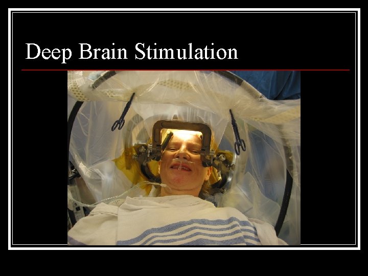 Deep Brain Stimulation 