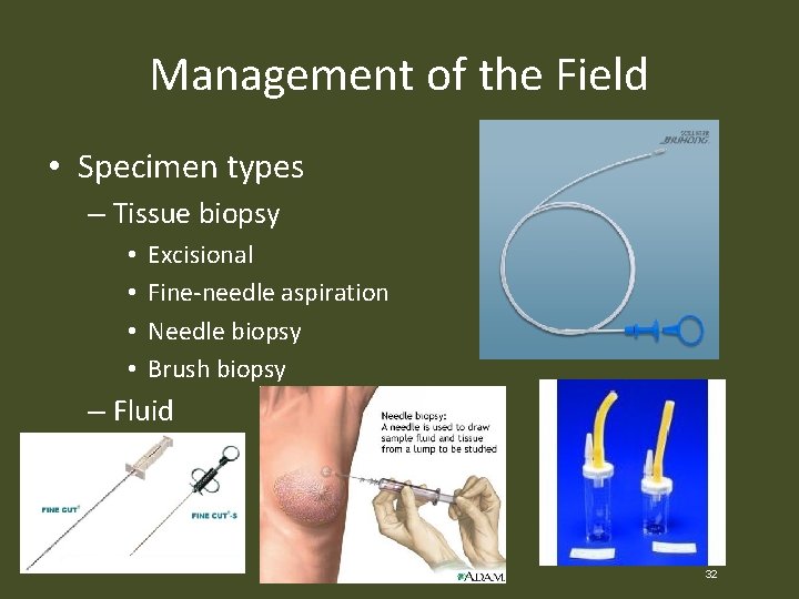 Management of the Field • Specimen types – Tissue biopsy • • Excisional Fine-needle