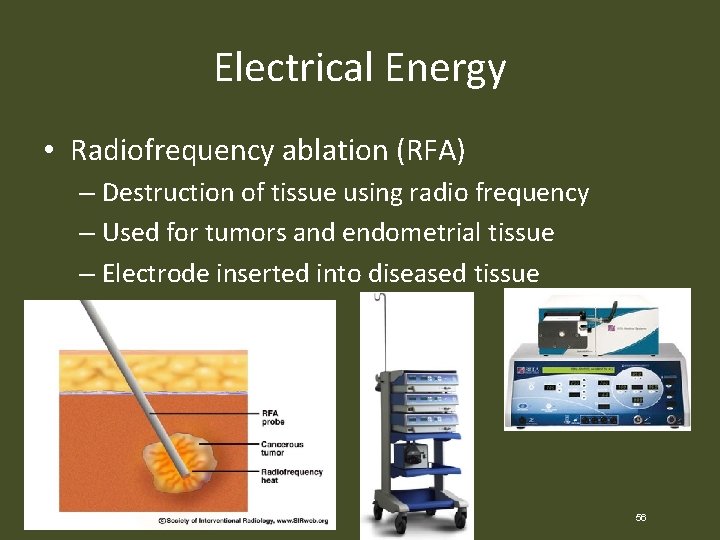 Electrical Energy • Radiofrequency ablation (RFA) – Destruction of tissue using radio frequency –