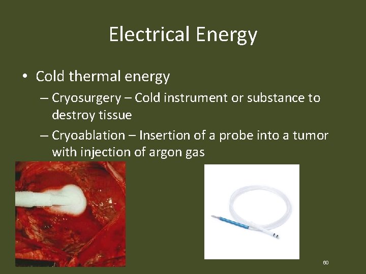 Electrical Energy • Cold thermal energy – Cryosurgery – Cold instrument or substance to