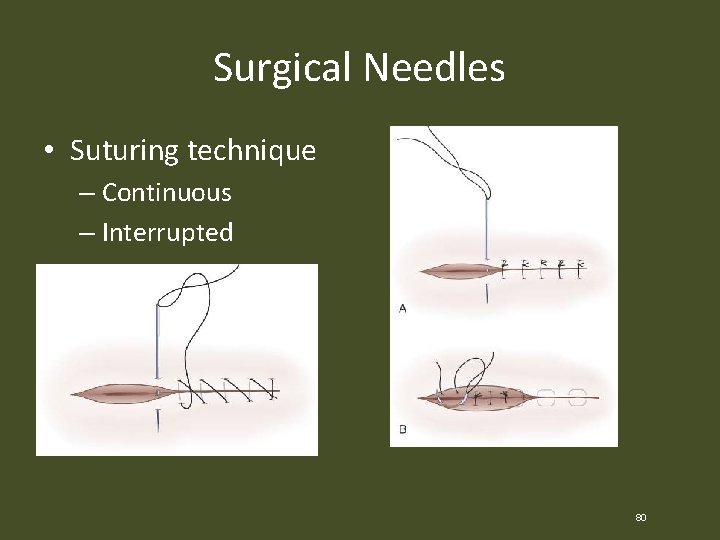 Surgical Needles • Suturing technique – Continuous – Interrupted 80 