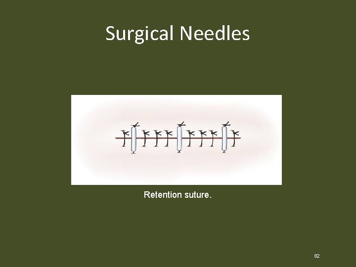 Surgical Needles Retention suture. 82 