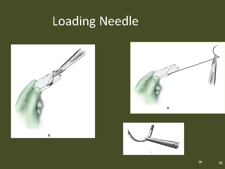 Loading Needle 86 86 