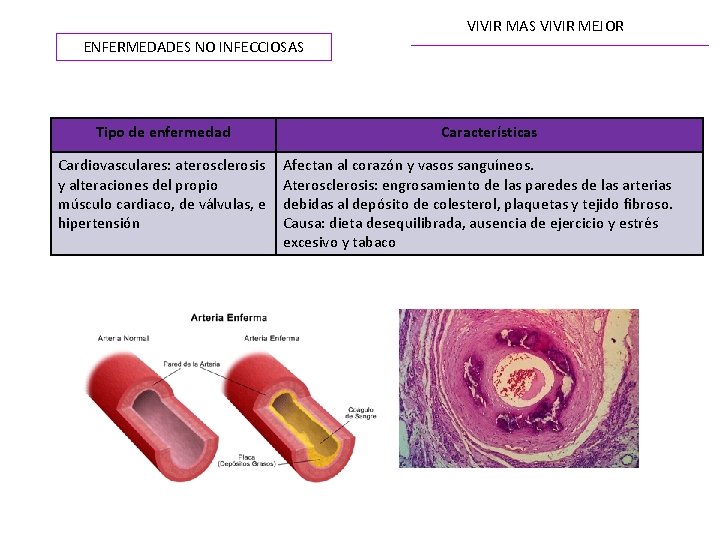 VIVIR MAS VIVIR MEJOR ENFERMEDADES NO INFECCIOSAS Tipo de enfermedad Cardiovasculares: aterosclerosis y alteraciones