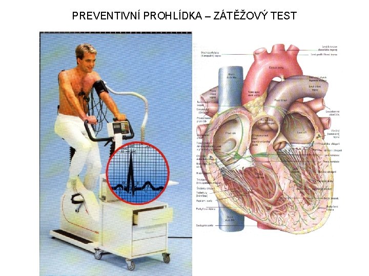 PREVENTIVNÍ PROHLÍDKA – ZÁTĚŽOVÝ TEST 