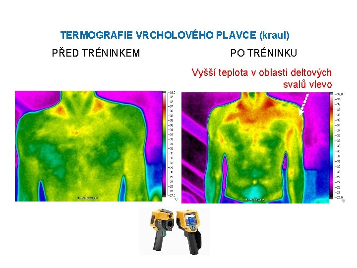 TERMOGRAFIE VRCHOLOVÉHO PLAVCE (kraul) PŘED TRÉNINKEM PO TRÉNINKU Vyšší teplota v oblasti deltových svalů