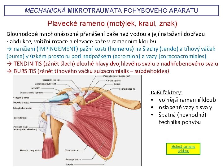 MECHANICKÁ MIKROTRAUMATA POHYBOVÉHO APARÁTU Plavecké rameno (motýlek, kraul, znak) Dlouhodobé mnohonásobné přenášení paže nad