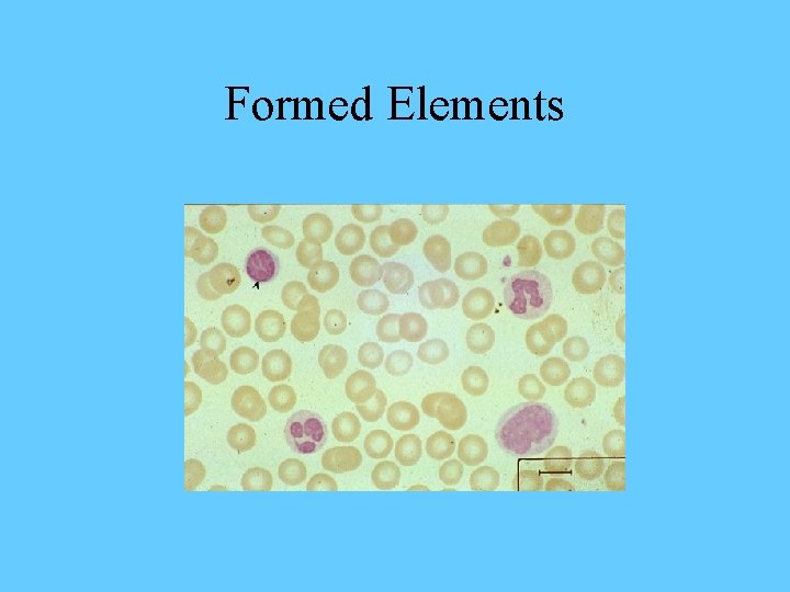 Formed Elements 