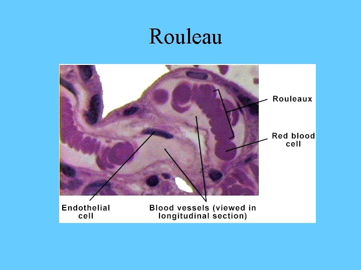Rouleau 