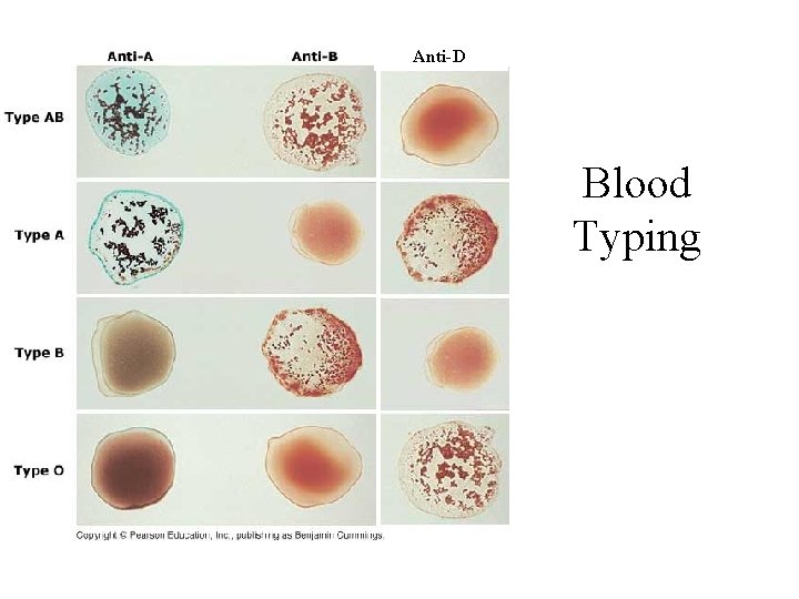 Anti-D Blood Typing 
