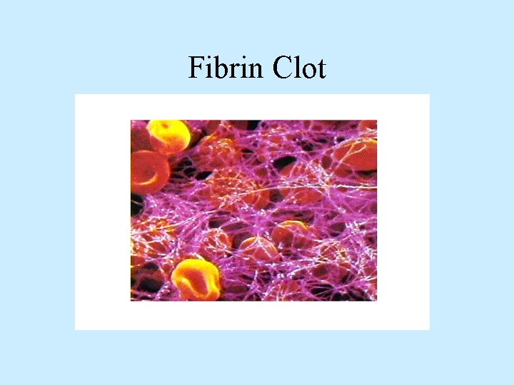 Fibrin Clot 