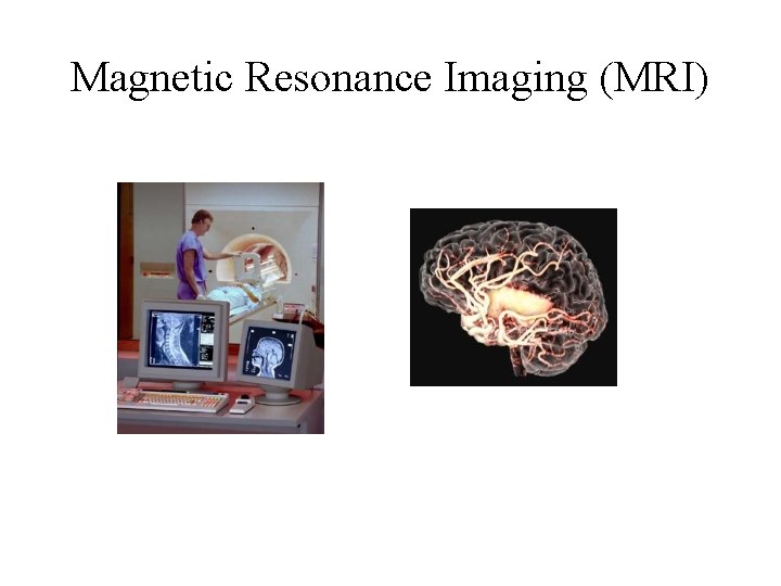 Magnetic Resonance Imaging (MRI) 