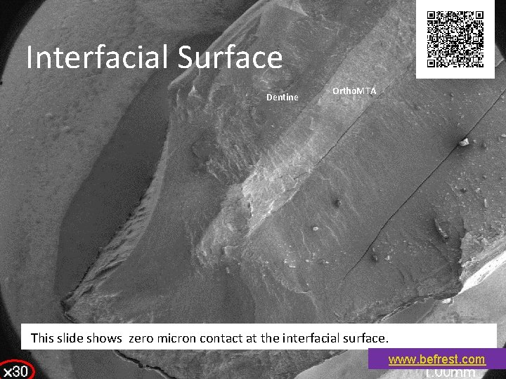 Interfacial Surface Dentine Ortho. MTA This slide shows zero micron contact at the interfacial