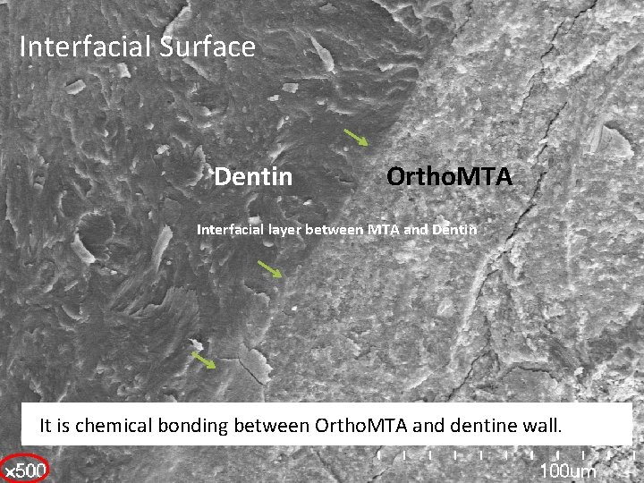 Interfacial Surface Dentin Ortho. MTA Interfacial layer between MTA and Dentin It is chemical