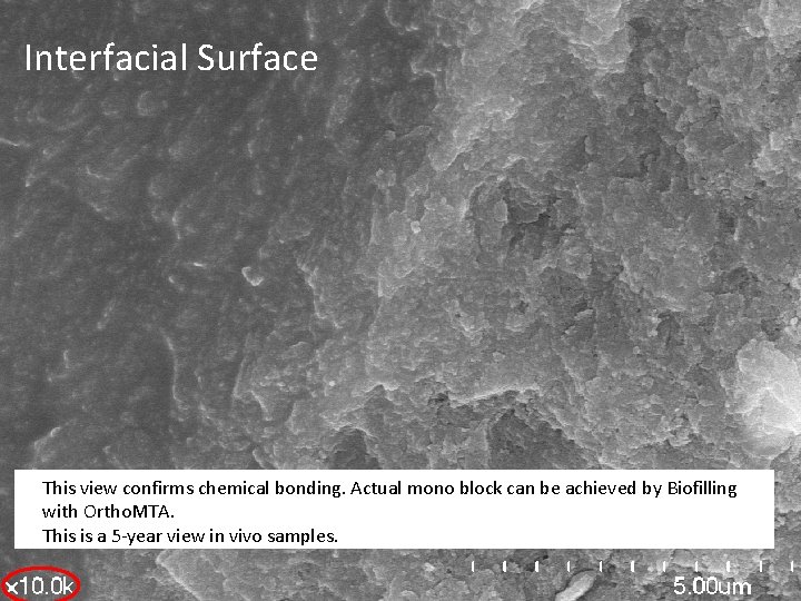 Interfacial Surface This view confirms chemical bonding. Actual mono block can be achieved by