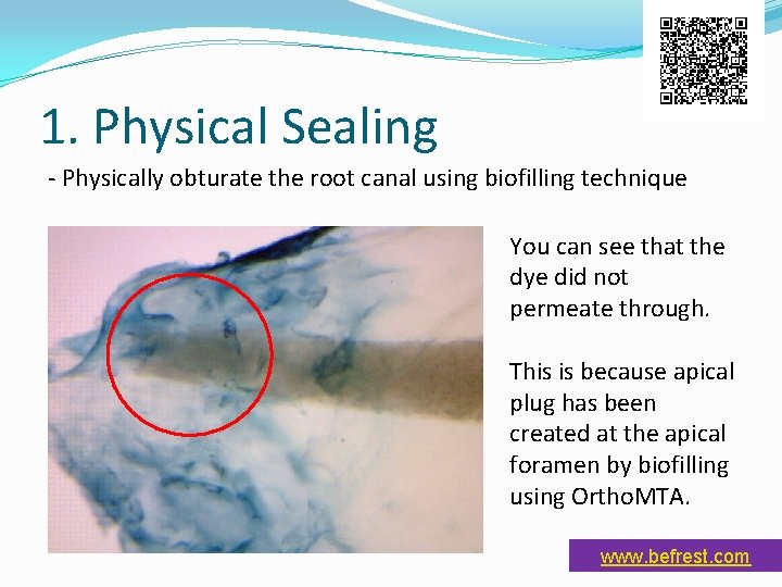 1. Physical Sealing - Physically obturate the root canal using biofilling technique You can