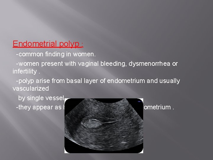 Endometrial polyp : -common finding in women. -women present with vaginal bleeding, dysmenorrhea or