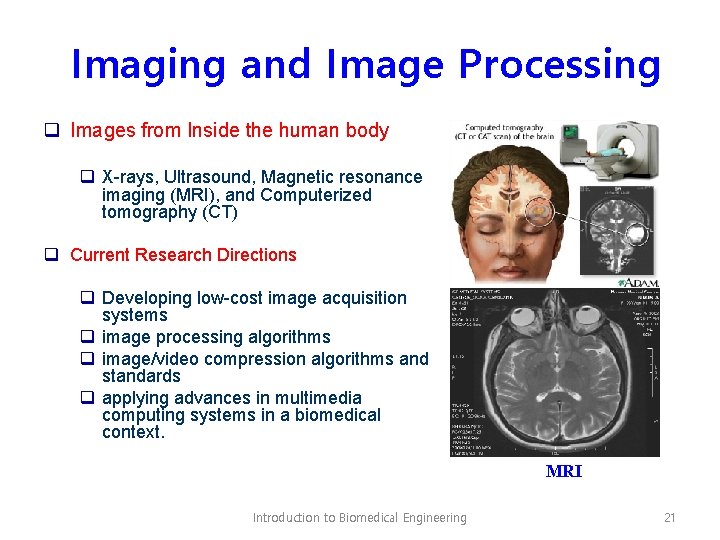 Imaging and Image Processing q Images from Inside the human body q X-rays, Ultrasound,