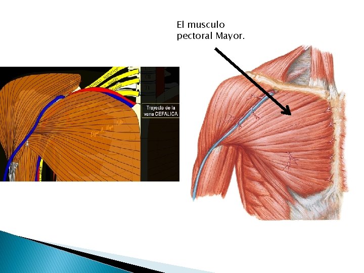 El musculo pectoral Mayor. 