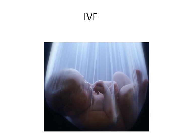 IVF IVF