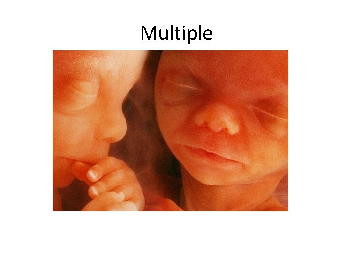 Multiple Multiple
