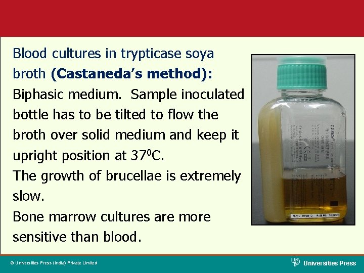 Blood cultures in trypticase soya broth (Castaneda’s method): Biphasic medium. Sample inoculated bottle has