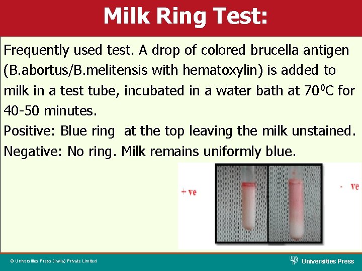 Milk Ring Test: Frequently used test. A drop of colored brucella antigen (B. abortus/B.