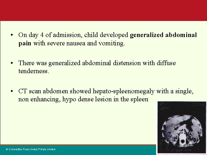  • On day 4 of admission, child developed generalized abdominal pain with severe