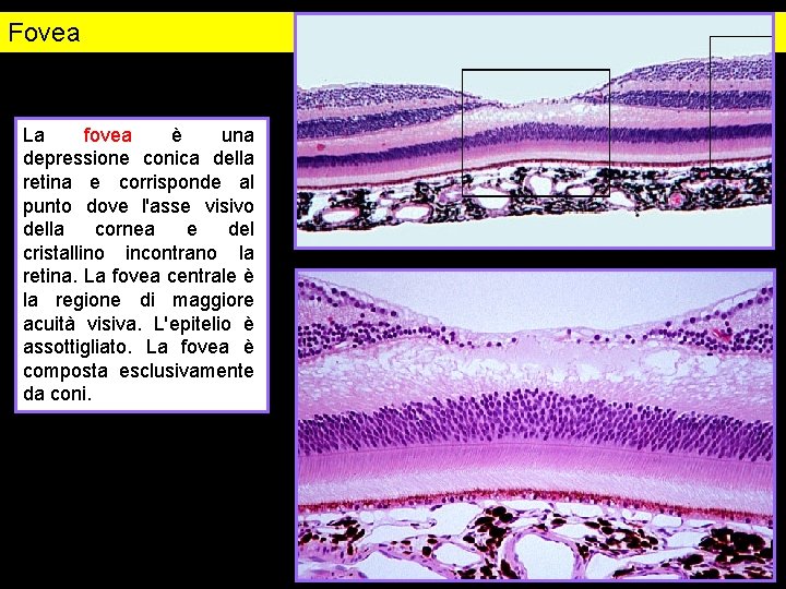 Fovea La fovea è una depressione conica della retina e corrisponde al punto dove