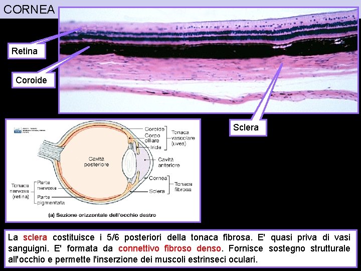 CORNEA Retina Coroide Sclera La sclera costituisce i 5/6 posteriori della tonaca fibrosa. E'