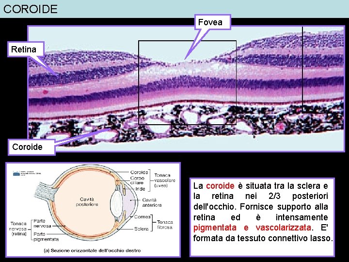 COROIDE Fovea Retina Coroide La coroide è situata tra la sclera e la retina