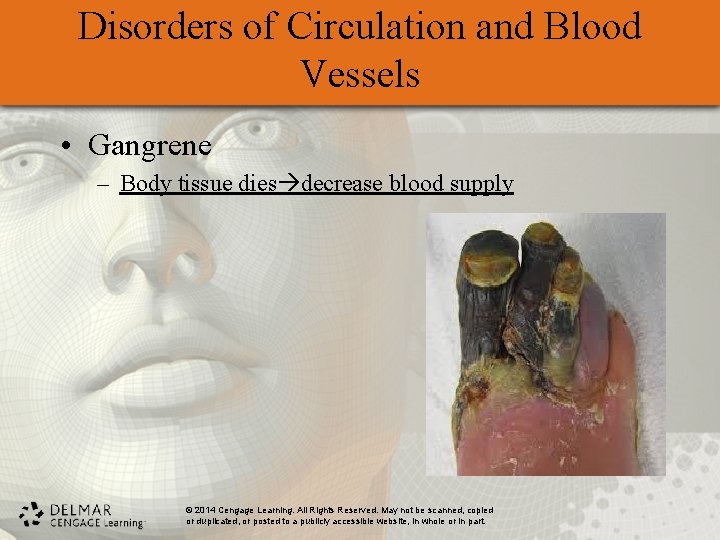 Disorders of Circulation and Blood Vessels • Gangrene – Body tissue dies decrease blood