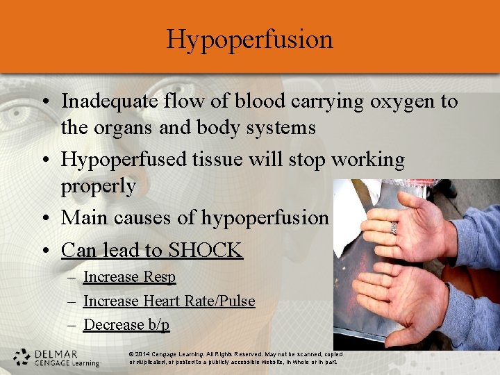 Hypoperfusion • Inadequate flow of blood carrying oxygen to the organs and body systems Hypoperfusion • Inadequate flow of blood carrying oxygen to the organs and body systems