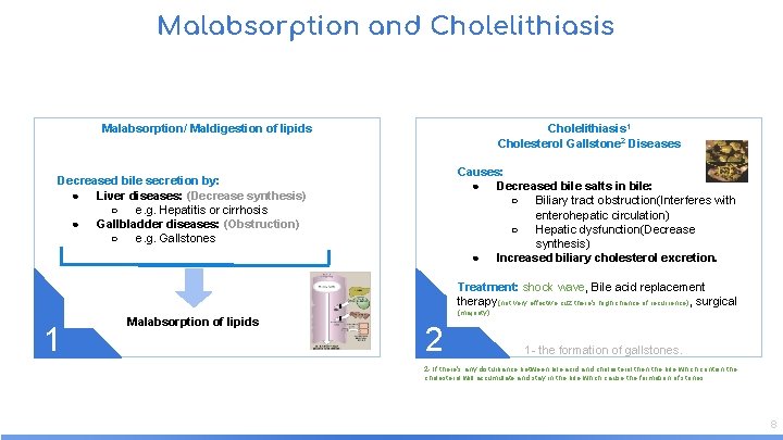 Malabsorption and Cholelithiasis Malabsorption/ Maldigestion of lipids Cholelithiasis 1 Cholesterol Gallstone 2 Diseases Causes: