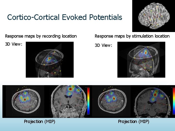 Cortico-Cortical Evoked Potentials Response maps by recording location Response maps by stimulation location 3