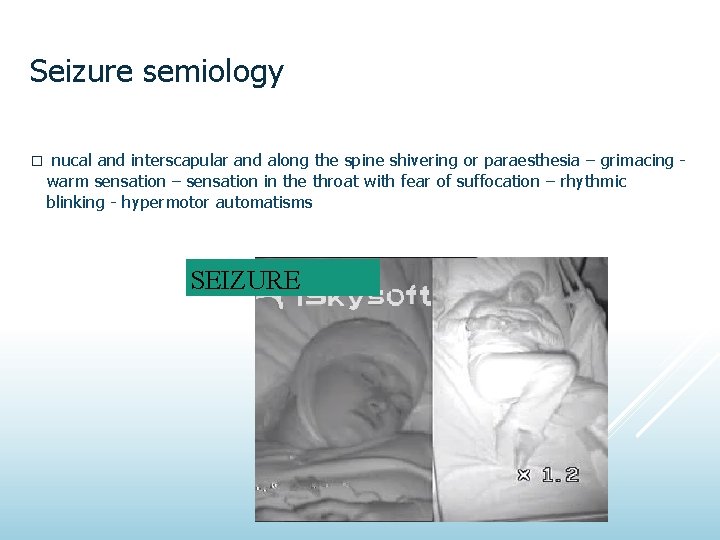Seizure semiology � nucal and interscapular and along the spine shivering or paraesthesia –